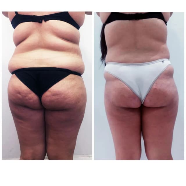 Resultado antes e depois 4