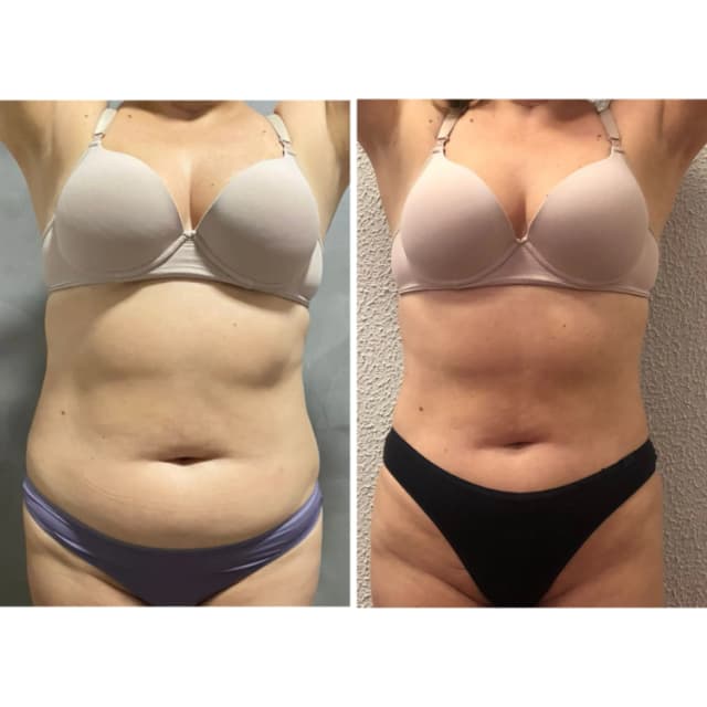 Resultado antes e depois 7