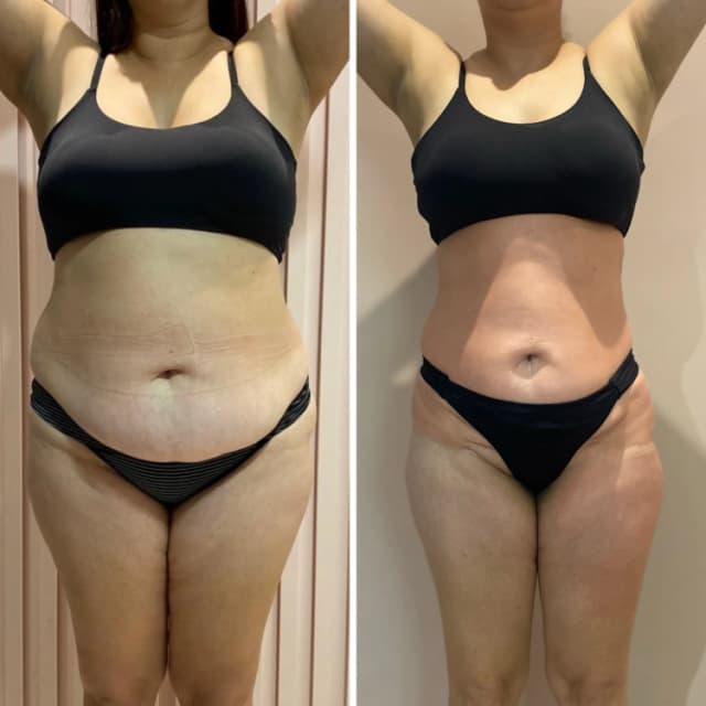 Resultado antes e depois 8